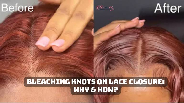 Bleaching knots on lace closure: why & how?