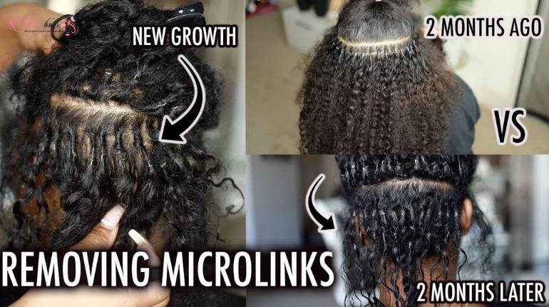 How To Take Out Microlinks Hair Extensions At Home?