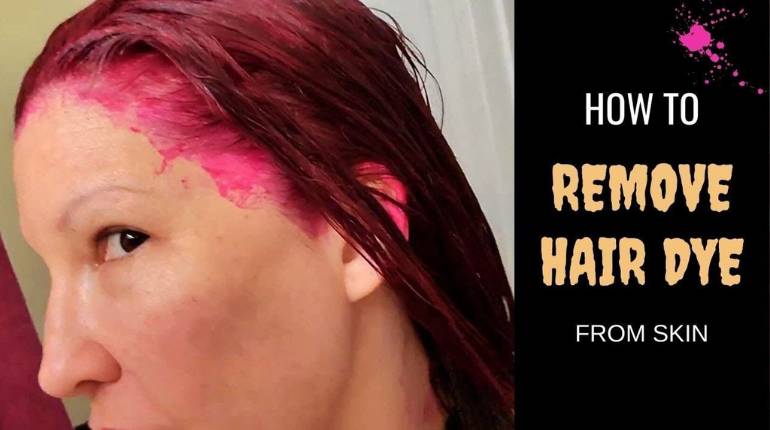 5-Simple-Ways-How-to-Get-Dye-Off-the-Scalp