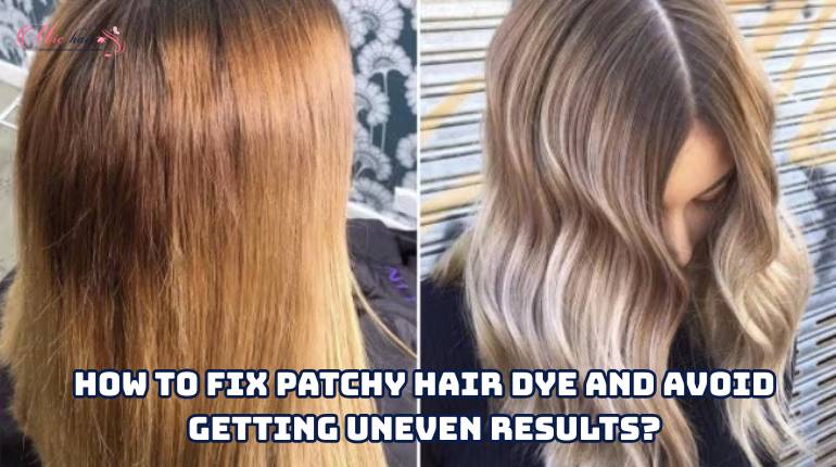 How To Fix Patchy Hair Dye And Avoid Getting Uneven Results?